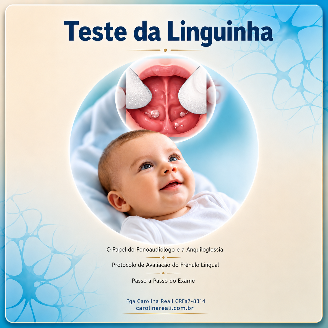 Teste da Linguinha - Guia Prático do Fonoaudiólogo
